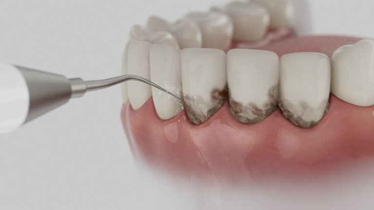 Reliable Dental contractor in Fulton County County, GA by Dentist Open Now